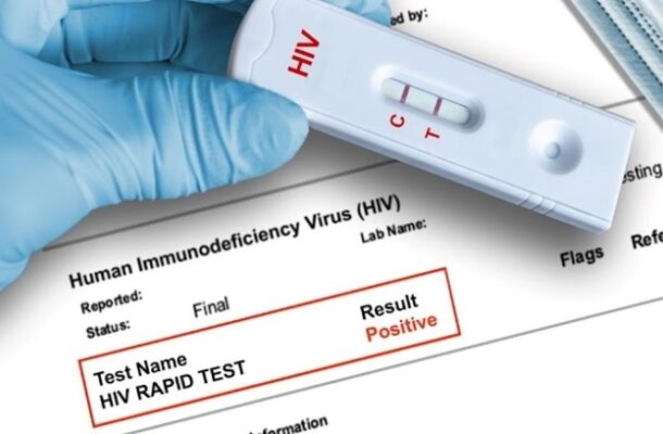 hiv